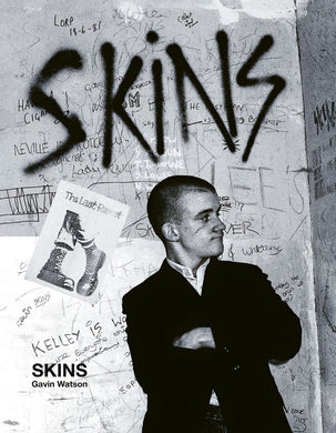 Skins: Gavin Watson USED BOOK