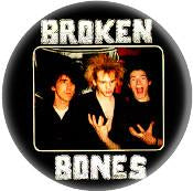 BROKEN BONES PIC button (1 inch)