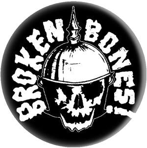 BROKEN BONES SKULL button (1 inch)